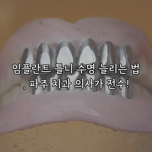 임플란트 틀니 수명 늘리는 법, 파주 치과 의사가 전수!